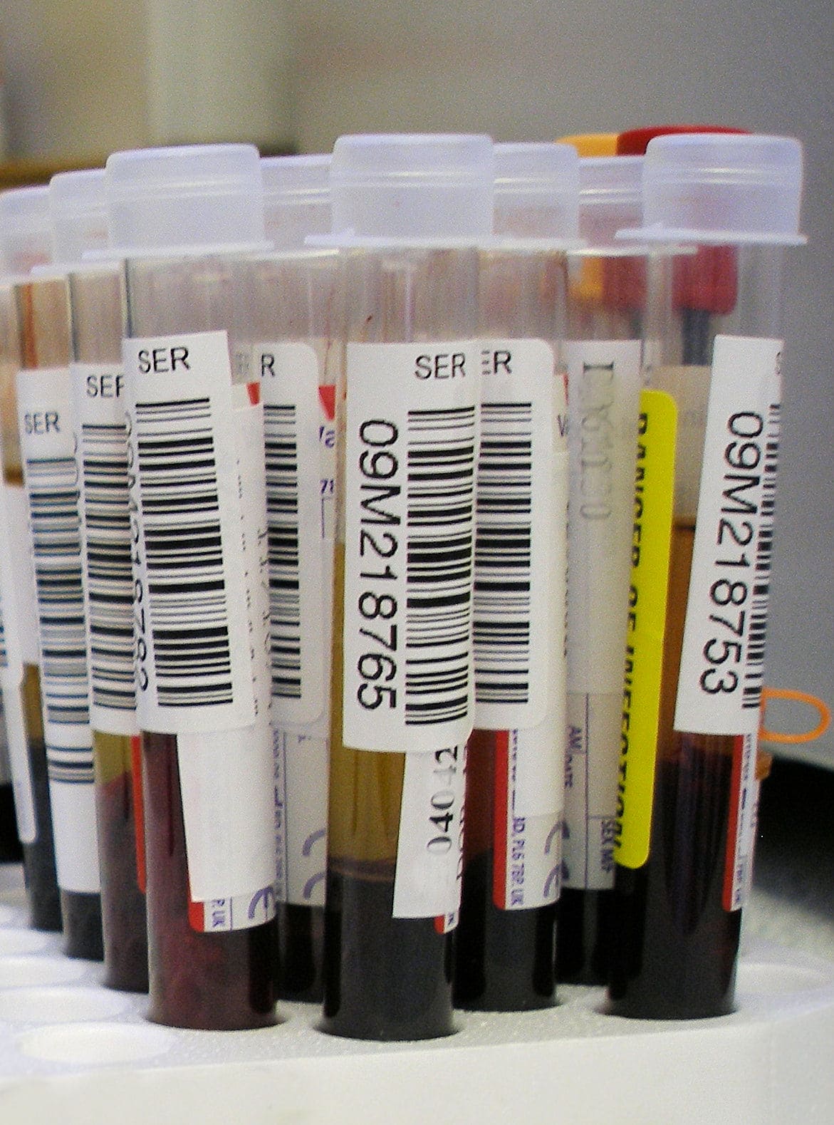 Cholesterol & Lipid Disorders